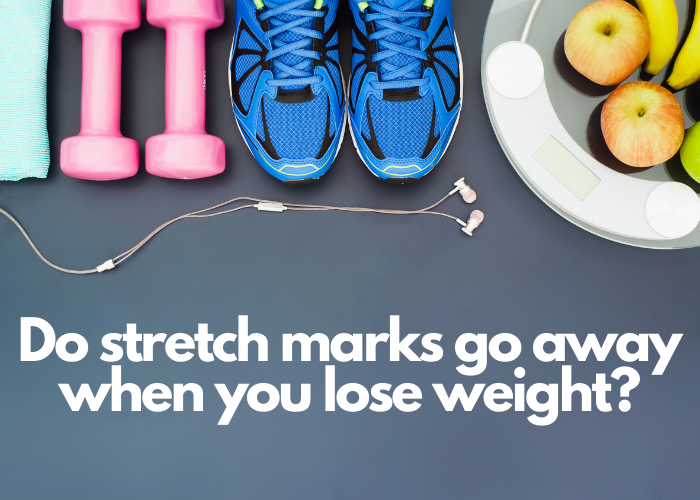Do stretch marks go away when you lose weight?
