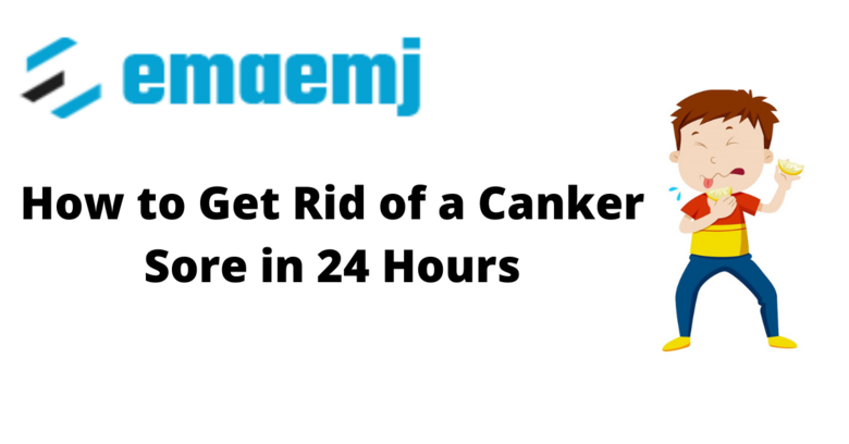 How to Get Rid of a Canker Sore in 24 Hours